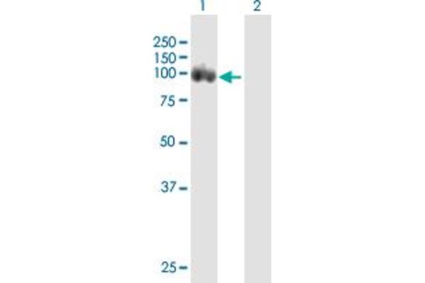 DAB2 anticorps  (AA 1-770)