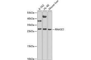 Western blot analysis of extracts of various cell lines, using RN antibody (ABIN6131626, ABIN6146986, ABIN6146987 and ABIN6225283) at 1:1000 dilution. (RNASE2 Antikörper  (AA 28-161))