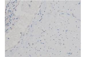 ABIN6267390 at 1/200 staining Human esophagus tissue sections by IHC-P. (ATF2 Antikörper  (pThr53, pThr71))