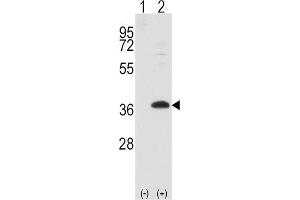 Western Blotting (WB) image for anti-Frequently Rearranged in Advanced T-Cell Lymphomas (FRAT1) antibody (ABIN2997937) (FRAT1 Antikörper)