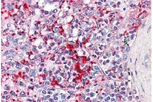 Human Spleen: Formalin-Fixed, Paraffin-Embedded (FFPE) (TLN1 Antikörper  (AA 1052-1150))