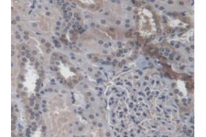 Detection of RAB37 in Human Kidney Tissue using Polyclonal Antibody to RAB37, Member RAS Oncogene Family (RAB37) (RAB37 Antikörper  (AA 19-220))
