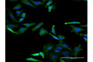 Immunofluorescence (IF) image for anti-RNA Binding Motif Protein 3 (RBM3) (AA 1-80) antibody (ABIN519669)