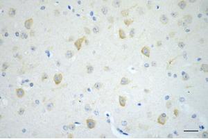 Immunohistochemistry was performed on paraffin-embedded mouse brain using CD19 antibody (ABIN7797954), 1:200).