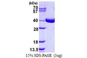 Image no. 1 for N-Acetylglucosamine Kinase (NAGK) protein (His tag) (ABIN1098243) (NAGK Protein (His tag))