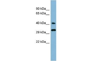 WB Suggested Anti-RBJ Antibody Titration: 0. (DNAJC27 Antikörper  (Middle Region))