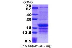 SDS-PAGE (SDS) image for Poly(rC) Binding Protein 1 (PCBP1) (AA 1-163) protein (His tag) (ABIN5853223) (PCBP1 Protein (AA 1-163) (His tag))