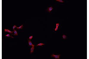 Immunofluorescence (fixed cells) (IF/ICC) image for anti-Myelin Protein Zero (MPZ) (C-Term) antibody (ABIN6263343)