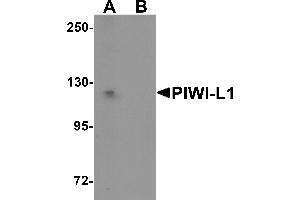 Western Blotting (WB) image for anti-Piwi-Like 1 (PIWIL1) (N-Term) antibody (ABIN1031515) (PIWIL1 Antikörper  (N-Term))