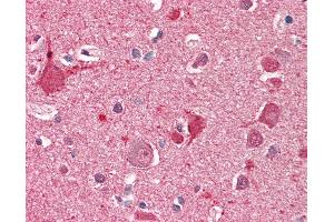 Anti-DOC2A antibody IHC staining of human brain, cortex. (DOC2A Antikörper  (AA 233-246))