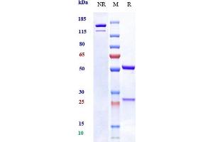Anti-OSMR Reference Antibody (vixarelimab) on SDS-PAGE under reducing (R) condition. (Rekombinanter OSMR (Vixarelimab Biosimilar) Antikörper)