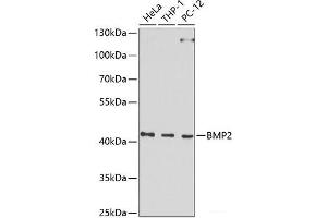 Western blot analysis of extracts of various cell lines using BMP2 Polyclonal Antibody at dilution of 1:1000. (BMP2 Antikörper)
