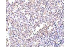 Immunohistochemistry (IHC) image for anti-Lymphocyte Antigen 96 (LY96) (AA 2-160) antibody (ABIN492534)