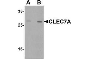 Western blot analysis of CLEC7A in rat spleen tissue lysate with CLEC7A antibody at (A) 1 and (B) 2 µg/. (CLEC7A Antikörper  (Middle Region))
