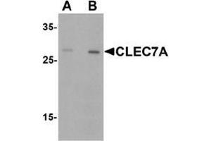 Western Blotting (WB) image for anti-C-Type Lectin Domain Family 7, Member A (CLEC7A) (Middle Region) antibody (ABIN1449932)