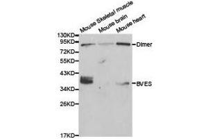 Western Blotting (WB) image for anti-Blood Vessel Epicardial Substance (BVES) antibody (ABIN1871374)