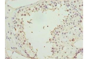Immunohistochemistry of paraffin-embedded human testis tissue using ABIN7155453 at dilution of 1:100 (Retinoblastoma Binding Protein 4 Antikörper  (AA 246-425))