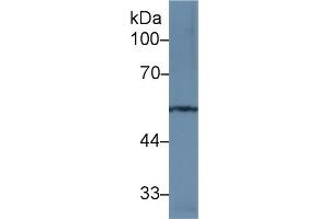 Detection of MMP12 in Rat Spinal cord lysate using Polyclonal Antibody to Matrix Metalloproteinase 12 (MMP12) (MMP12 Antikörper  (AA 100-286))