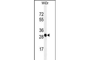 Western blot analysis of QR3 Antibody (C-term) (ABIN650916 and ABIN2839993) in WiDr cell line lysates (35 μg/lane). (PAQR3 Antikörper  (C-Term))