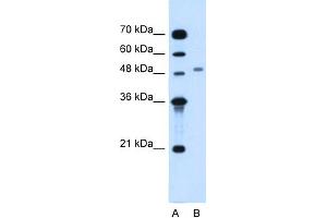 WB Suggested Anti-MGAT2 Antibody Titration:  1. (MGAT2 Antikörper  (Middle Region))