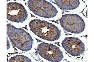 IHC analysis of ME1 using anti-ME1 antibody (ABIN7599485). (ME1 Antikörper  (AA 1-572))