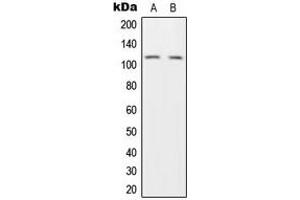 Western blot analysis of HGS expression in H1299 (A), HeLa (B) whole cell lysates. (HGS Antikörper  (Center))