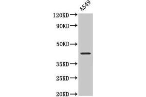 Western Blot Positive WB detected in: A549 whole cell lysate All lanes: NDRG4 antibody at 2 μg/mL Secondary Goat polyclonal to rabbit IgG at 1/50000 dilution Predicted band size: 39, 38, 41, 43, 40 kDa Observed band size: 43 kDa (NDRG4 Antikörper  (AA 210-331))