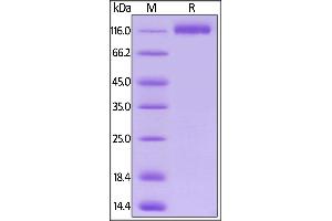 Biotinylated Human VEGF R1, His,Avitag on  under reducing (R) condition. (FLT1 Protein (AA 27-756) (His tag,AVI tag,Biotin))