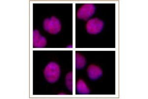 MMSET / WHSC1 antibody (mAb) tested by immunofluorescence.