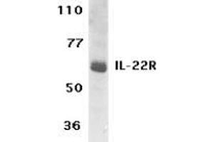 Western blot analysis of IL-22 Receptor expression in human HepG2 cell lysate with AP30416PU-N IL-22 Receptor antibody at 1 μg /ml. (IL22 Receptor alpha 1 Antikörper  (C-Term))