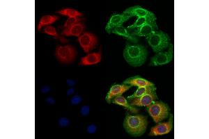 ABIN6263421 and ABIN6273057 staining Hela cells by IF/ICC.