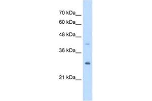 Western Blotting (WB) image for anti-Calcyclin Binding Protein (CACYBP) antibody (ABIN2463420) (CACYBP Antikörper)