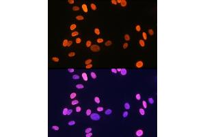 Immunofluorescence analysis of U-2 OS cells using Histone H1. (HIST1H1C Antikörper)