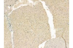 ABIN6262191 and ABIN6269396 at 1/100 staining human normal liver tissue by IHC-P. (HDAC8 Antikörper  (N-Term))