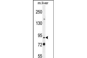 Parp9 Antibody (N-term) (ABIN656129 and ABIN2845470) western blot analysis in mouse liver tissue lysates (35 μg/lane).