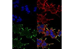 Immunocytochemistry/Immunofluorescence analysis using Mouse Anti-Alpha B Crystallin Monoclonal Antibody, Clone 1A7.