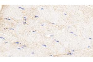 Immunohistochemistry (IHC) image for anti-Fatty Acid Binding Protein 3, Muscle and Heart (FABP3) (AA 1-133) antibody (ABIN7443005)