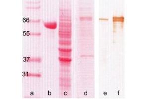 Western Blotting (WB) image for anti-Myxovirus Resistance Protein 1 (MX1) antibody (ABIN781793) (MX1 Antikörper)