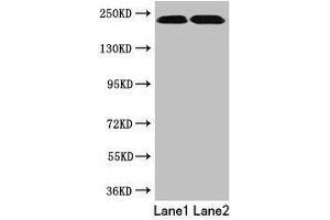Western blot All lanes: TLN2 antibody at 12 μg/mL Lane 1: Hela whole cell lysate Lane 2: Jurkat whole cell lysate Secondary Goat polyclonal to rabbit IgG at 1/10000 dilution Predicted band size: 272 kDa Observed band size: 230 kDa (TLN2 Antikörper  (AA 88-406))