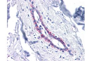 Immunohistochemistry (IHC) image for anti-Cadherin 1, Type 1, E-Cadherin (Epithelial) (CDH1) (Middle Region) antibody (ABIN503222) (E-cadherin Antikörper  (Middle Region))