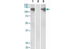 HEK293 lysate (10 ug protein in RIPA buffer) overexpressing human PUM2 with DYKDDDDK tag probed with PUM2 polyclonal antibody  (0. (PUM2 Antikörper  (Internal Region))