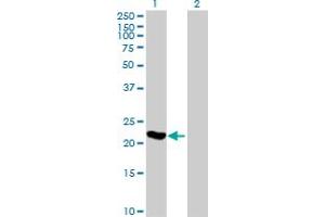 Western Blot analysis of ARL3 expression in transfected 293T cell line by ARL3 MaxPab polyclonal antibody. (ARL3 Antikörper  (AA 1-182))