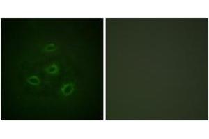 Immunofluorescence analysis of HepG2 cells, using PP2A-alpha (Ab-307) Antibody. (PPP2CA Antikörper  (AA 260-309))