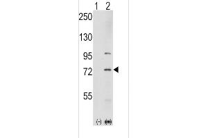 Western blot analysis of K1 (arrow) using rabbit polyclonal K1 Antibody  (ABIN392432 and ABIN2842032). (PAK1 Antikörper  (AA 401-430))