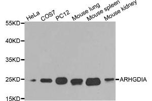 Western blot analysis of extracts of various cell lines, using ARHGDIA antibody (ABIN5970556) at 1/1000 dilution.
