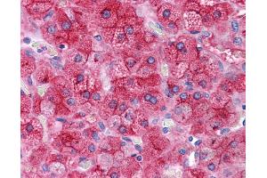 ApoE antibody was used for immunohistochemistry at a concentration of 4-8 ug/ml. (APOE Antikörper  (N-Term))