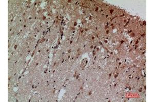 Immunohistochemistry (IHC) analysis of paraffin-embedded Human Brain, antibody was diluted at 1:100.
