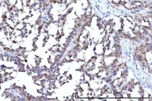 IHC analysis of RANBP2 using anti-RANBP2 antibody (ABIN7602650). (RANBP2 Antikörper  (AA 906-2744))
