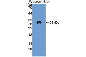 Western blot analysis of the recombinant protein. (Reelin Antikörper  (AA 2398-2608))