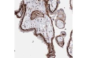 Immunohistochemical staining of human placenta with C11orf52 polyclonal antibody  shows strong membranous positivity. (C11ORF52 Antikörper)